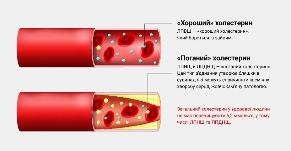 «Хороший» і «поганий» холестерин: норма і відхилення